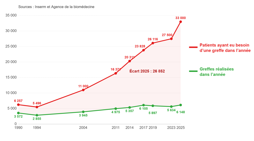Graphique : évolution du nombre de malades en attente et de greffes réalisées en France de 1990 à 2025 (sources : Inserm et Agence de la biomédecine)